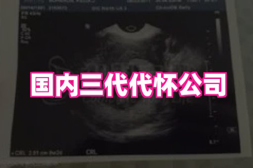 长春助孕网 4